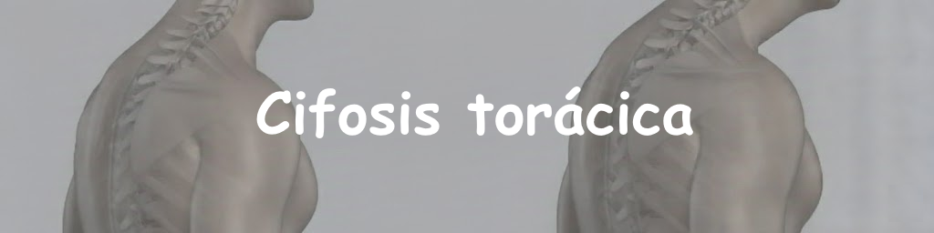 Cifosis torácica aumentada: espalda alta encorvada frente a postura con tórax más extendido